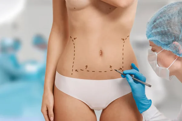VASER Assisted Liposuction