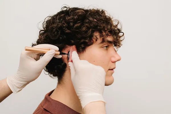 Otoplasty