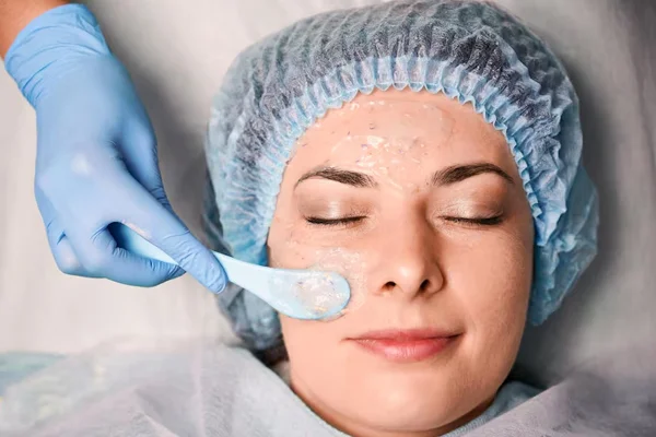Chemical Peels